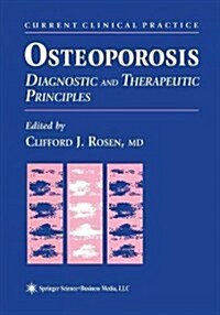 Osteoporosis: Diagnostic and Therapeutic Principles (Paperback, Softcover Repri)