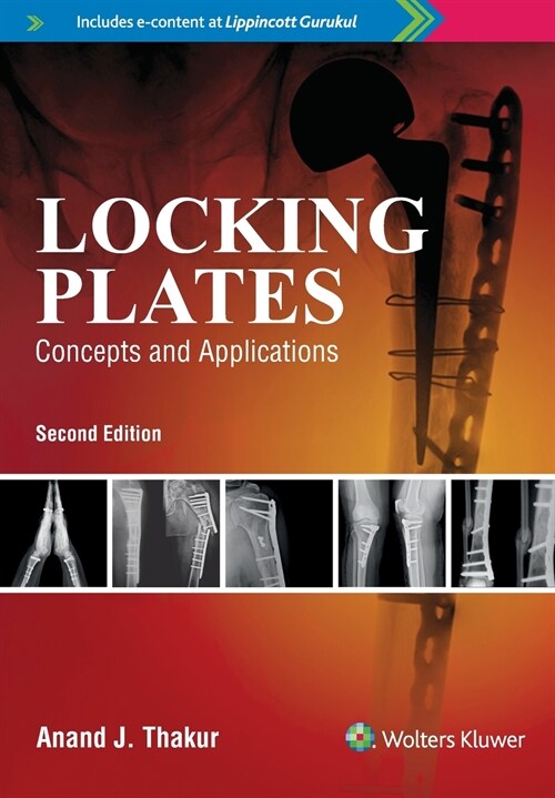 Locking Plates Concepts And Applications, 2E (Paperback)