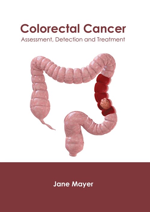 Colorectal Cancer: Assessment, Detection and Treatment (Hardcover)