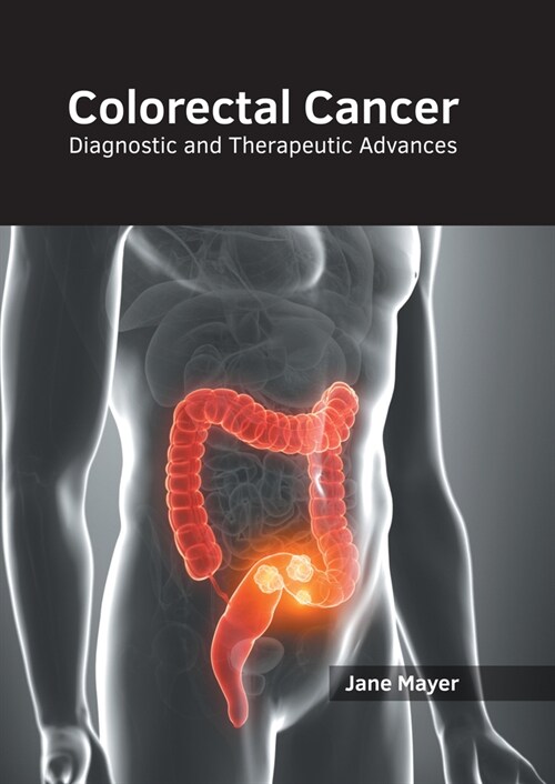 Colorectal Cancer: Diagnostic and Therapeutic Advances (Hardcover)