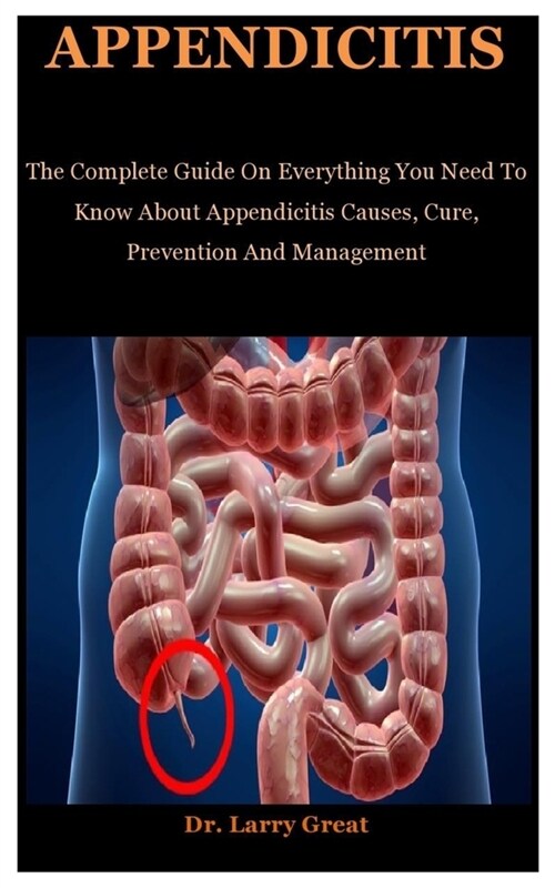 Appendicitis: The Complete Guide On Everything You To Need Know About Appendicitis Causes, Cure, Prevention And Management (Paperback)