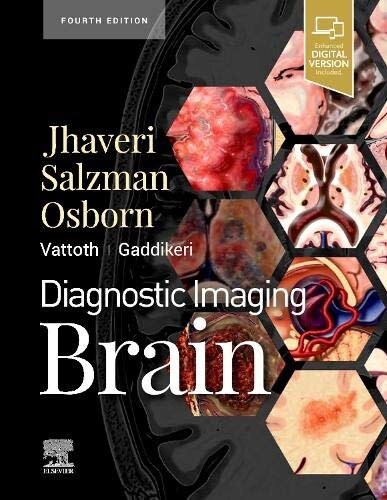 Diagnostic Imaging: Brain (Hardcover, 4)