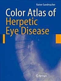 Color Atlas of Herpetic Eye Disease: A Practical Guide to Clinical Management (Hardcover, 2009)