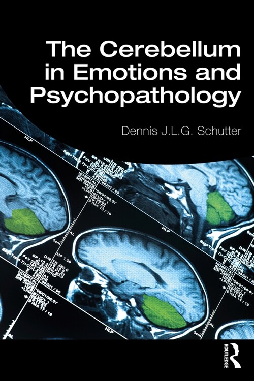 The Cerebellum in Emotions and Psychopathology (Paperback)