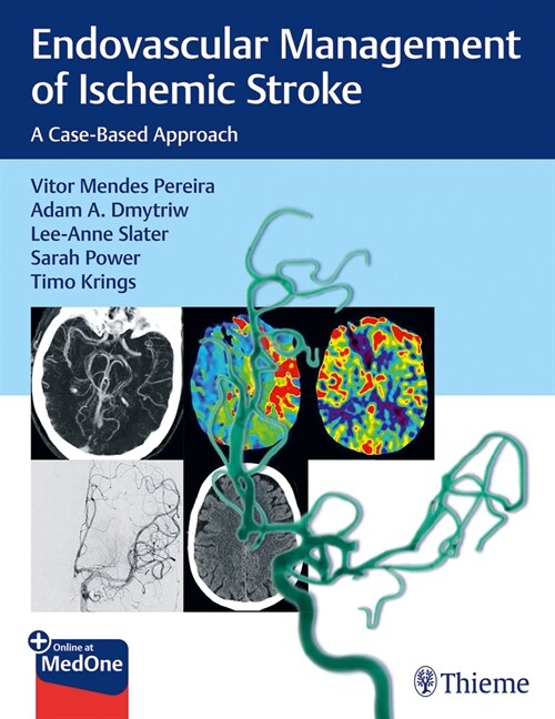 Endovascular Management of Ischemic Stroke: A Case-Based Approach (Paperback)