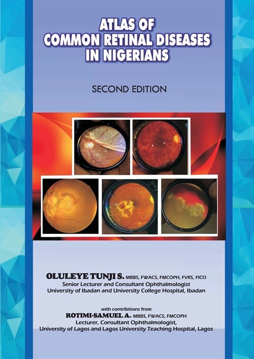 The Atlas of Retinal Diseases in Nigerians (Paperback)
