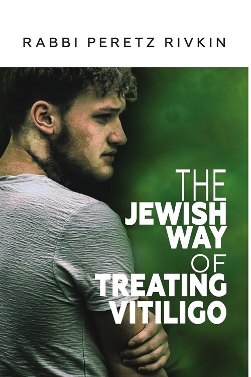 The Jewish Way of Treating Vitiligo (Paperback)