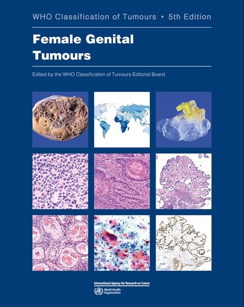 Female Genital Tumours: Who Classification of Tumours (Paperback, 5)