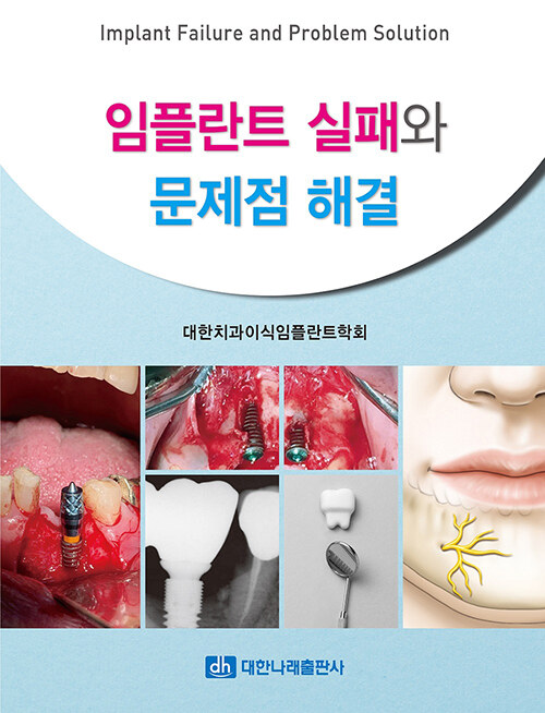 임플란트 실패와 문제점 해결