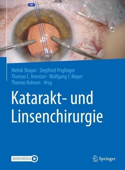 Katarakt- Und Linsenchirurgie (Hardcover, 1. Aufl. 2021)