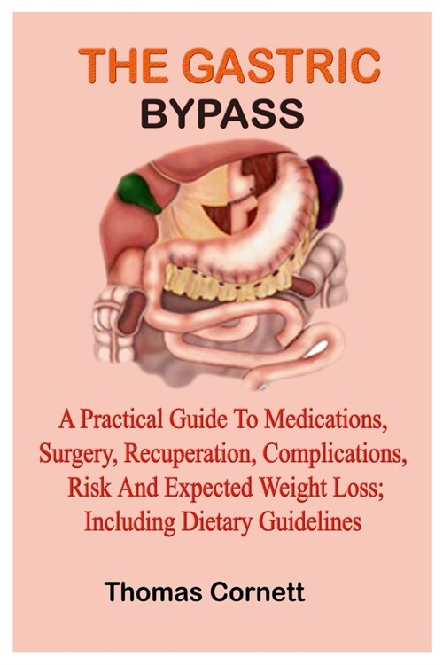 The Gastric Bypass: A Practical Guide to Medications, Surgery, Recuperation, Complications, Risk and Expected Weight Loss; Including Dieta (Paperback)