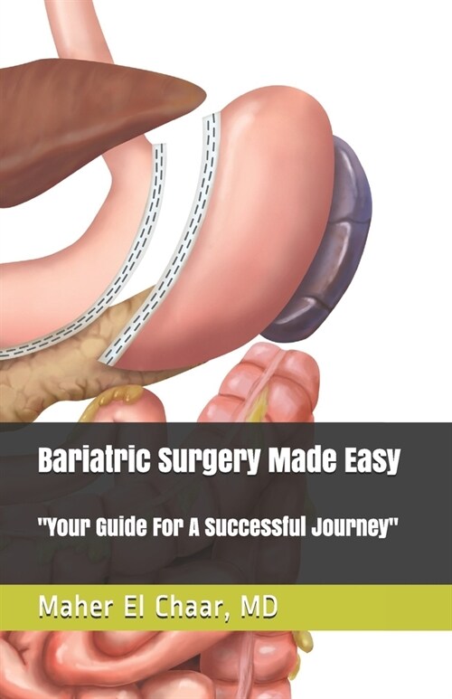 Bariatric Surgery Made Easy: : Your Guide For A Successful Journey (Paperback)
