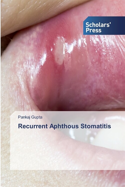 Recurrent Aphthous Stomatitis (Paperback)