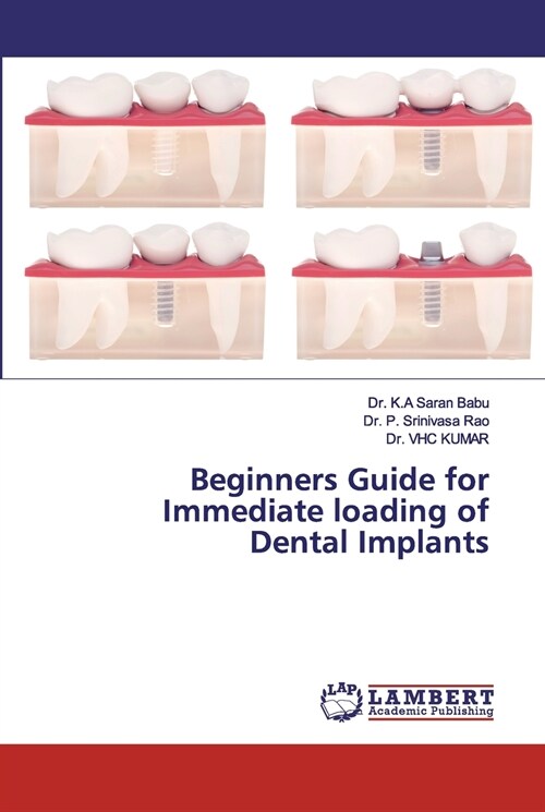 Beginners Guide for Immediate loading of Dental Implants (Paperback)