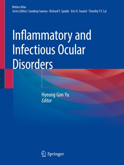 Inflammatory and Infectious Ocular Disorders (Paperback)