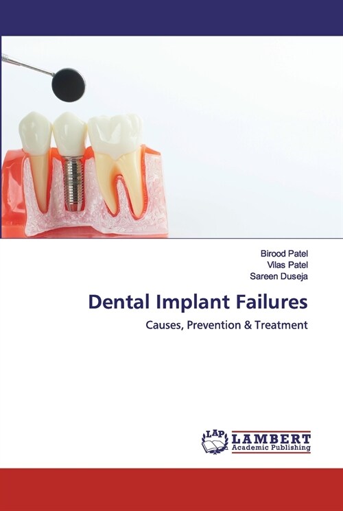 Dental Implant Failures (Paperback)