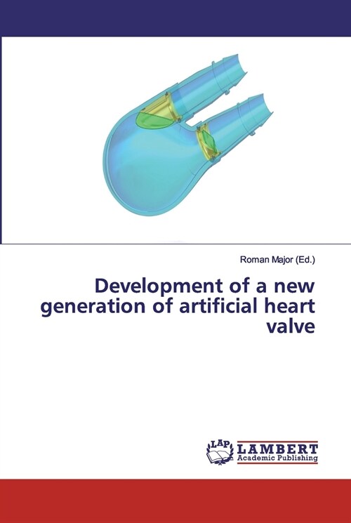 Development of a new generation of artificial heart valve (Paperback)