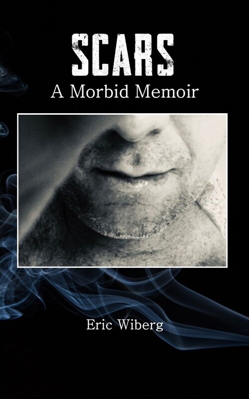 Scars: A Morbid Memoir (Paperback)