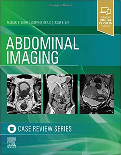 Abdominal Imaging: Case Review Series (Paperback)