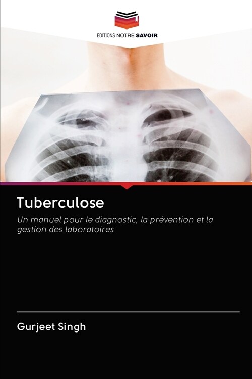 Tuberculose (Paperback)