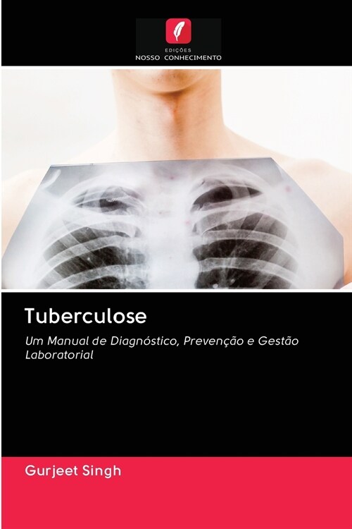 Tuberculose (Paperback)