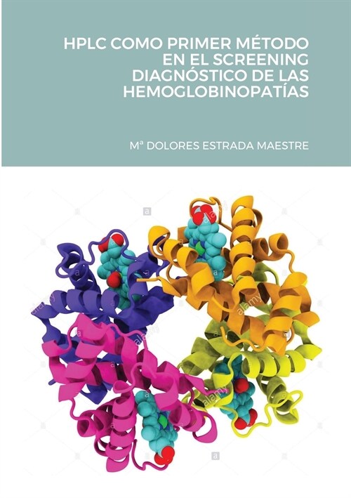 HPLC Como Primer M?odo En El Screening Diagn?tico de Las Hemoglobinopat?s (Paperback)