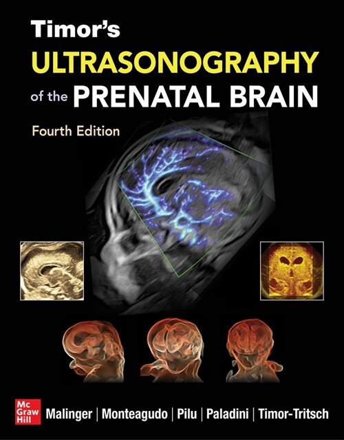 Timors Ultrasonography of the Prenatal Brain, Fourth Edition (Hardcover, 4)