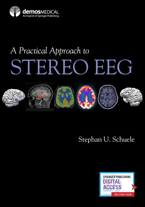 A Practical Approach to Stereo EEG (Paperback)