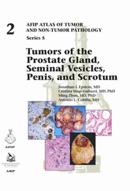 Tumors of the Prostate Gland, Seminal Vesicles, Penis, and Scrotum (Hardcover)