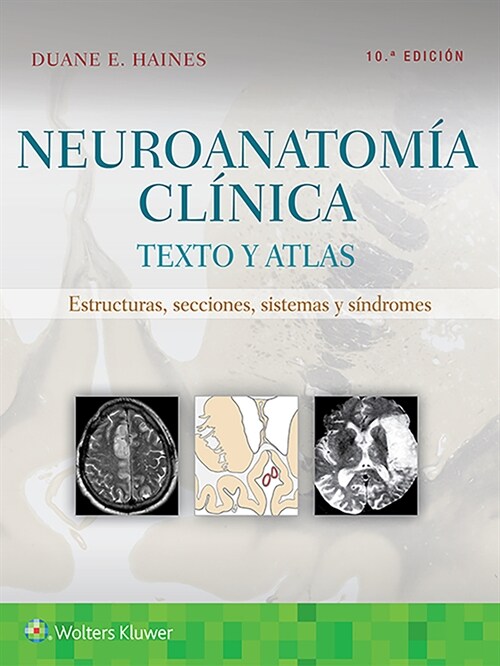 Neuroanatom? Cl?ica: Texto Y Atlas (Paperback, 10)