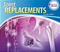 Joint Replacements (Library Binding)