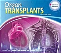 Organ Transplants (Library Binding)