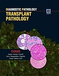 Diagnostic Pathology: Transplant Pathology (Hardcover)