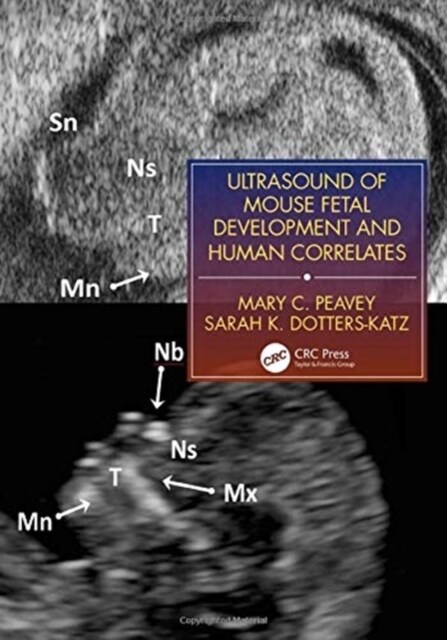 Ultrasound of Mouse Fetal Development and Human Correlates (Hardcover)