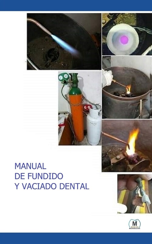 Manual de Fundido y Vaciado Dental: Gu? Pr?tica (Paperback)