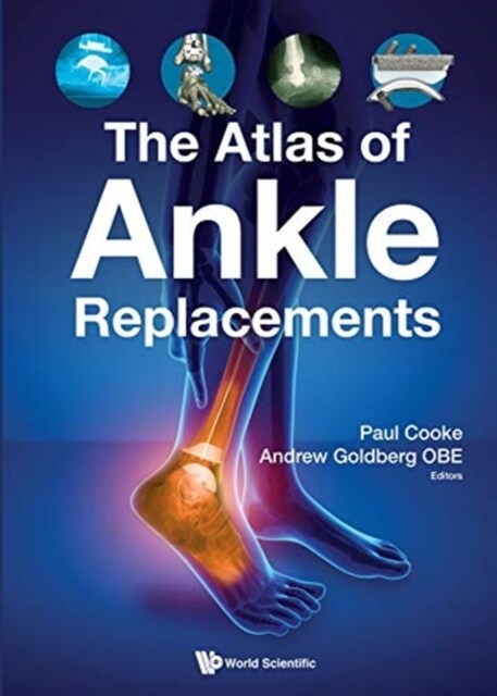 Atlas Of Ankle Replacements, The (Paperback)