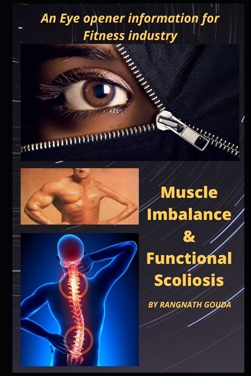 Muscle imbalance & Functional Scoliosis: An Eye opener Information for fitness industry (Paperback)