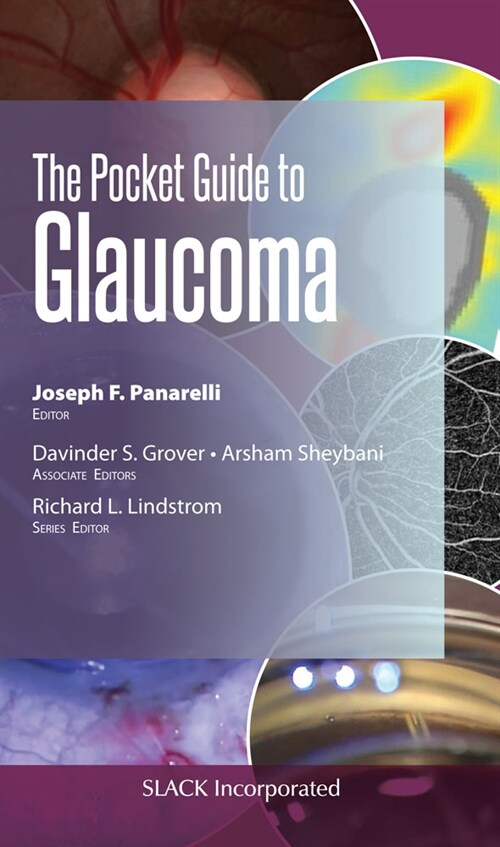 The Pocket Guide to Glaucoma (Paperback)