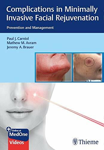 Complications in Minimally Invasive Facial Rejuvenation: Prevention and Management (Hardcover)