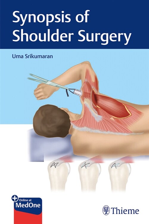 Synopsis of Shoulder Surgery (Paperback)