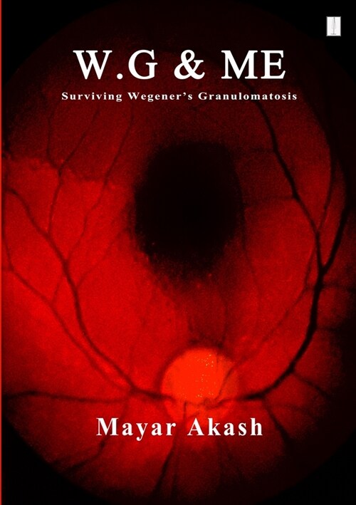 W.G & ME, Surviving Wegeners Granulomatosis: Wegeners Granulomatosis (Paperback)