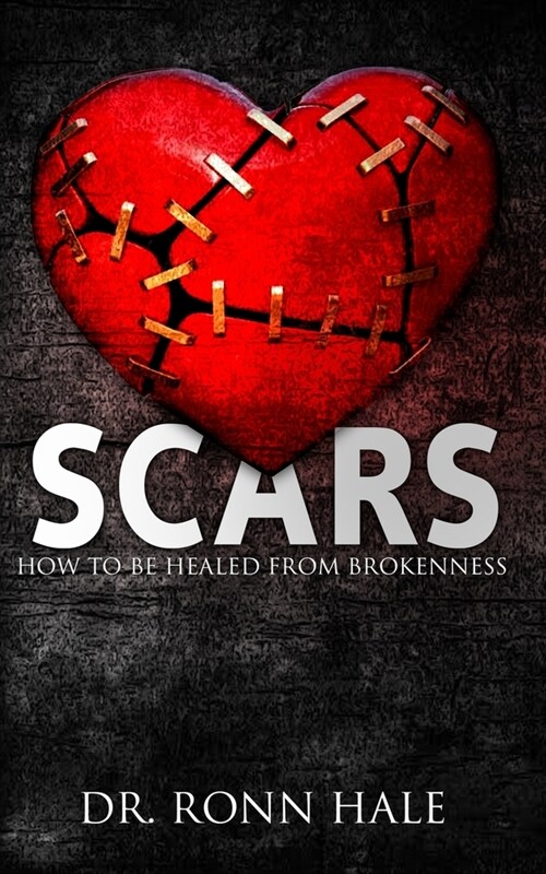 Scars: How to Be Healed from Brokenness (Paperback)