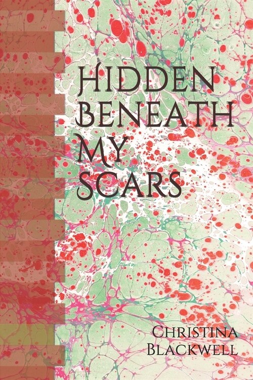 Hidden Beneath My Scars (Paperback)