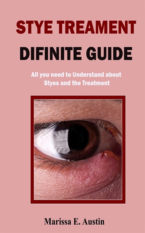 Stye Treatment Difinite Guide: All you need to Understand about Styes and the Treatment (Paperback)