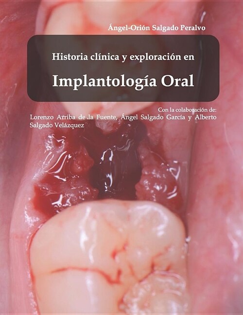 Histor? cl?ica y exploraci? en Implantolog? Oral (Paperback)