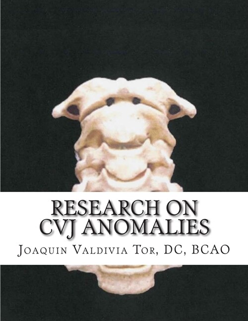 Research on CVJ anomalies (Paperback)