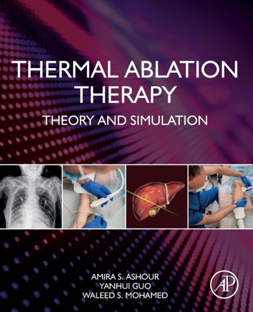 Thermal Ablation Therapy: Theory and Simulation (Paperback)
