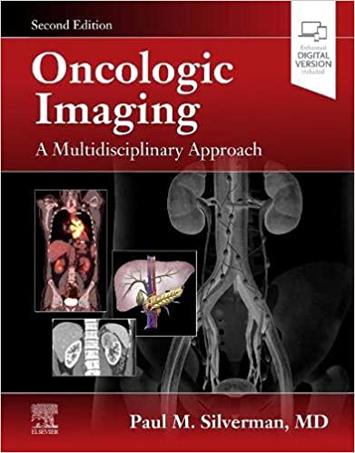 Oncologic Imaging: A Multidisciplinary Approach (Hardcover, 2)