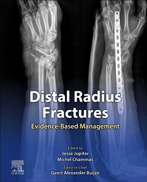 Distal Radius Fractures: Evidence-Based Management (Hardcover)