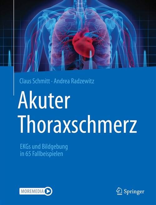 Akuter Thoraxschmerz: EKGs Und Bildgebung in 65 Fallbeispielen (Paperback, 1. Aufl. 2021)